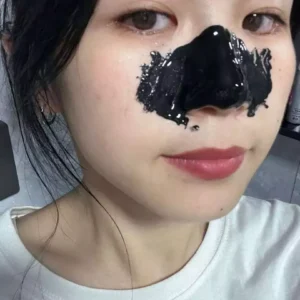 Gel Mụn Klena 0,1 và 0,3 hỗ trợ mụn ẩn, mụn đầu đen mụn trứng cá và ngừa mụn
