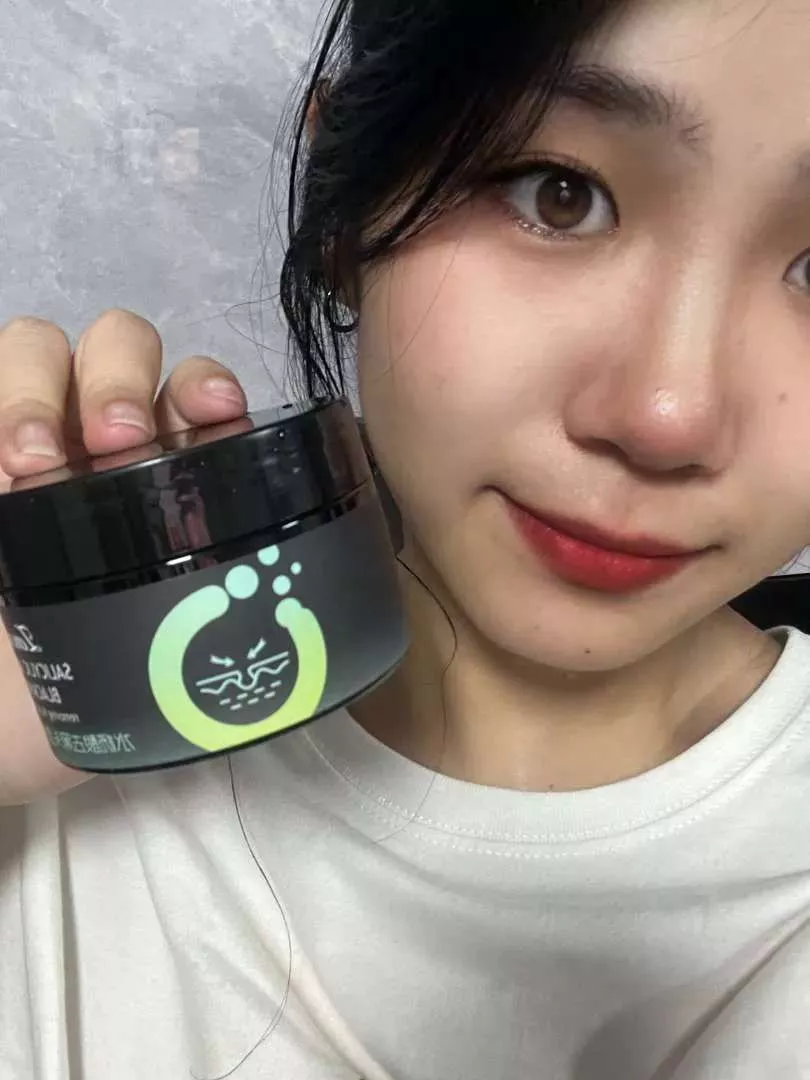 Gel Mụn Klena 0,1 và 0,3 hỗ trợ mụn ẩn, mụn đầu đen mụn trứng cá và ngừa mụn